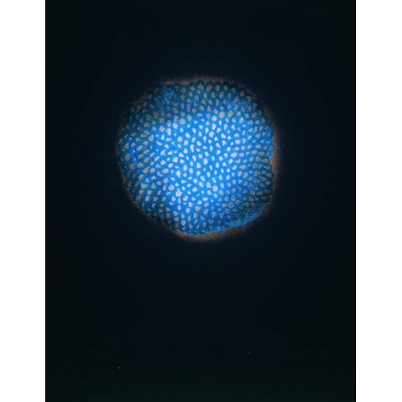 Sin título, 1954 (pastel y blanco sobre papel), Yayoi Kusama